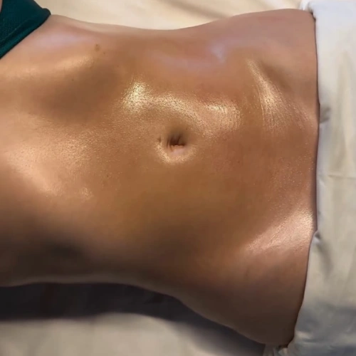 depois resultados da drenagem linfática Miracle Touch